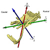 Figure 3. Typical 6DOF motion at the sternocostal joint of the first sternal rib. Left: sternocostal joint coordinate system. Right: rotations of the first sternal rib around its own articulation with the sternum. The red trace depicts X axis, pump-handle motion, green Y axis caliper rotation, and the blue trace Z axis bucket-handle motion.